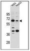 Solute Carrier Family 9 Member B1 antibody, AP52873PU-N, Origene, Western Blot image 