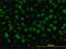 DNA repair and recombination protein RAD54B antibody, H00025788-M01, Novus Biologicals, Immunofluorescence image 