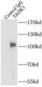 TAO Kinase 3 antibody, FNab08498, FineTest, Immunoprecipitation image 
