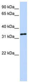HAD antibody, TA346461, Origene, Western Blot image 