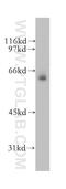 Male-specific lethal 3 homolog antibody, 12977-1-AP, Proteintech Group, Western Blot image 