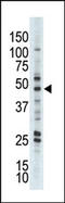 PKB beta antibody, AP13564PU-N, Origene, Western Blot image 