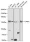 Cytoplasmic FMR1 Interacting Protein 1 antibody, GTX64502, GeneTex, Western Blot image 