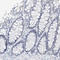 V-set and immunoglobulin domain-containing protein 8 antibody, HPA023219, Atlas Antibodies, Immunohistochemistry frozen image 