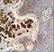 Collagen Type XIX Alpha 1 Chain antibody, LS-C166921, Lifespan Biosciences, Immunohistochemistry paraffin image 