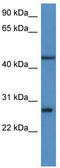 Fibroblast Growth Factor Binding Protein 2 antibody, TA342998, Origene, Western Blot image 