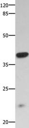 Ciliary neurotrophic factor receptor subunit alpha antibody, TA324163, Origene, Western Blot image 