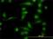 Aldo-Keto Reductase Family 1 Member B10 antibody, H00057016-M01, Novus Biologicals, Immunocytochemistry image 