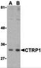 Complement C1q tumor necrosis factor-related protein 1 antibody, 3555, ProSci, Western Blot image 