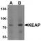 Kelch Like ECH Associated Protein 1 antibody, TA319790, Origene, Western Blot image 