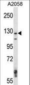MAP3K6 antibody, LS-C164456, Lifespan Biosciences, Western Blot image 