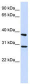 Inhibitor Of Growth Family Member 4 antibody, TA339724, Origene, Western Blot image 