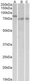 Interferon Regulatory Factor 2 Binding Protein 1 antibody, STJ72491, St John