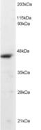 Origin Recognition Complex Subunit 4 antibody, LS-C55203, Lifespan Biosciences, Western Blot image 