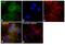 FAS antibody, MA5-14887, Invitrogen Antibodies, Immunofluorescence image 