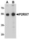 Purinergic Receptor P2X 7 antibody, MBS153696, MyBioSource, Western Blot image 