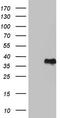 Glucosylceramidase Beta antibody, TA803473, Origene, Western Blot image 