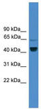 Zinc Finger RANBP2-Type Containing 2 antibody, TA339112, Origene, Western Blot image 