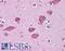 Hepatocyte Growth Factor antibody, LS-B4657, Lifespan Biosciences, Immunohistochemistry frozen image 