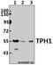Tryptophan Hydroxylase 1 antibody, GTX66644, GeneTex, Western Blot image 