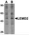 LEM Domain Containing 2 antibody, NBP2-82103, Novus Biologicals, Western Blot image 