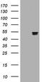 Thymidine Phosphorylase antibody, TA800999BM, Origene, Western Blot image 
