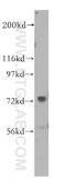 Methylphosphate Capping Enzyme antibody, 11526-1-AP, Proteintech Group, Western Blot image 