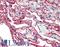S100 Calcium Binding Protein A10 antibody, LS-B3445, Lifespan Biosciences, Immunohistochemistry paraffin image 