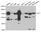 Lymphocyte Cytosolic Protein 1 antibody, abx004260, Abbexa, Western Blot image 