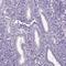 Karyopherin Subunit Alpha 5 antibody, NBP2-38715, Novus Biologicals, Immunohistochemistry paraffin image 