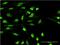 Oxidative Stress Responsive Kinase 1 antibody, MA5-20867, Invitrogen Antibodies, Immunofluorescence image 