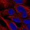 Coiled-Coil Domain Containing 130 antibody, HPA056977, Atlas Antibodies, Immunofluorescence image 