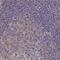 Sorbin And SH3 Domain Containing 1 antibody, NBP2-33383, Novus Biologicals, Immunohistochemistry paraffin image 