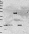 Fatty Acid Desaturase 3 antibody, NBP1-91877, Novus Biologicals, Western Blot image 