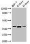 Hydroxyacid Oxidase 2 antibody, CSB-PA882145LA01HU, Cusabio, Western Blot image 