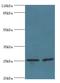 Charged Multivesicular Body Protein 5 antibody, LS-C372179, Lifespan Biosciences, Western Blot image 