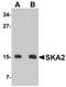 Spindle And Kinetochore Associated Complex Subunit 2 antibody, TA306844, Origene, Western Blot image 