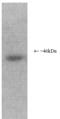 Proteasome 26S Subunit, ATPase 6 antibody, BML-PW8220-0100, Enzo Life Sciences, Western Blot image 