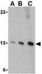Presenilin Enhancer, Gamma-Secretase Subunit antibody, GTX85064, GeneTex, Western Blot image 