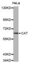Catalase antibody, abx004037, Abbexa, Western Blot image 
