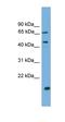 DnaJ Heat Shock Protein Family (Hsp40) Member A2 antibody, orb330663, Biorbyt, Western Blot image 