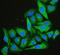 Cofilin 2 antibody, M04773, Boster Biological Technology, Immunofluorescence image 