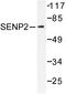 Sentrin-specific protease 2 antibody, LS-C176346, Lifespan Biosciences, Western Blot image 