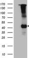 Interleukin 12 Receptor Subunit Beta 1 antibody, TA808195S, Origene, Western Blot image 