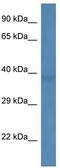 Beta-1,3-N-Acetylgalactosaminyltransferase 1 (Globoside Blood Group) antibody, TA335426, Origene, Western Blot image 