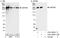 Centrosomal protein of 290 kDa antibody, A301-659A, Bethyl Labs, Immunoprecipitation image 