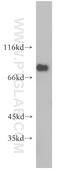 Spermatogenesis Associated 7 antibody, 12020-1-AP, Proteintech Group, Western Blot image 