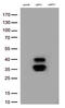 Palmitoyl-Protein Thioesterase 1 antibody, TA800618, Origene, Western Blot image 