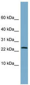 Leucine Rich Repeat Containing 20 antibody, TA344895, Origene, Western Blot image 