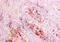 Rhizopus arrhizus antibody, AM05895PU-N, Origene, Immunohistochemistry frozen image 